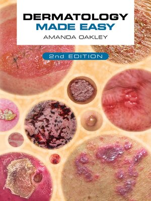 cover image of Dermatology Made Easy